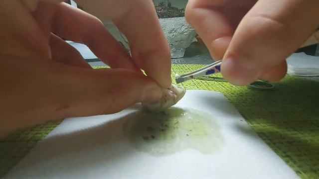 Кесарево сечение яйцу! смотреть онлайн