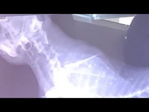 Кузю НЕ Сбила Машина. Что Же Случилось