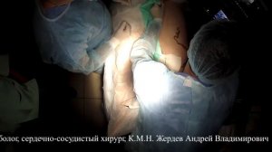 Радиочастотная абляция (РЧА) - по методике VNUS Closure