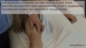 Фурункулы, карбункулы