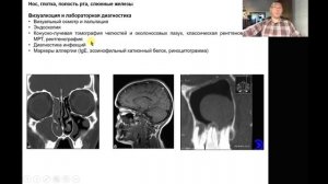 Что такое антигенная разгрузка?