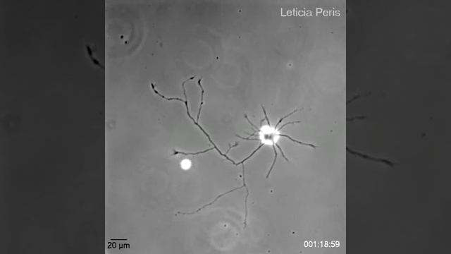Рост отростков одного нейрона. смотреть онлайн