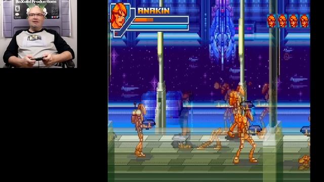 How To Install the Retron SQ Day 0 Patch & Fix GBA Performance Issues смотреть онлайн