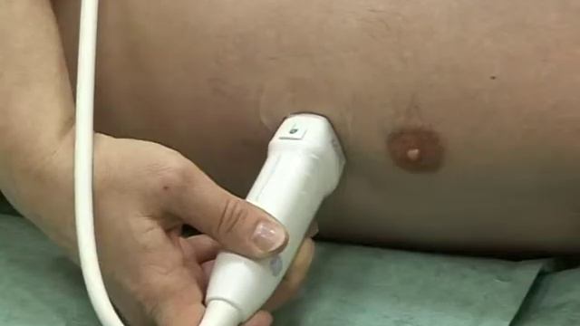 УЗИ сердца смотреть онлайн