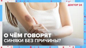 О чём говорят СИНЯКИ на теле без причины? | Доктор 24