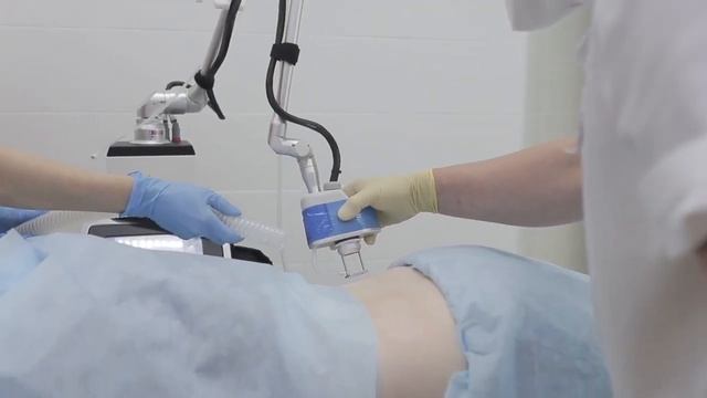 Шлифовка растяжек и стрий смотреть онлайн