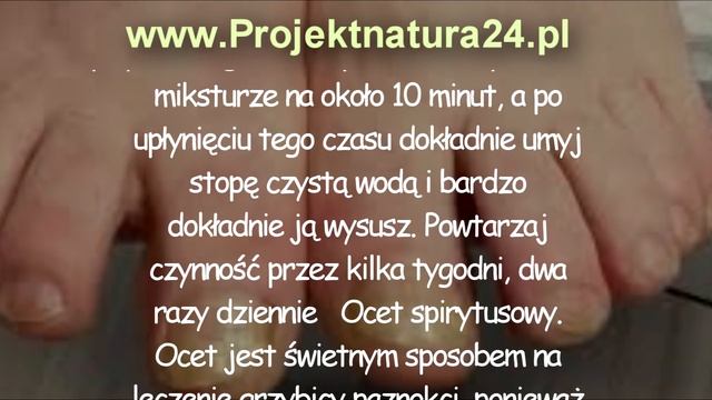 Jak Pozbyć Się Grzybicy Szybko I Naturalnie