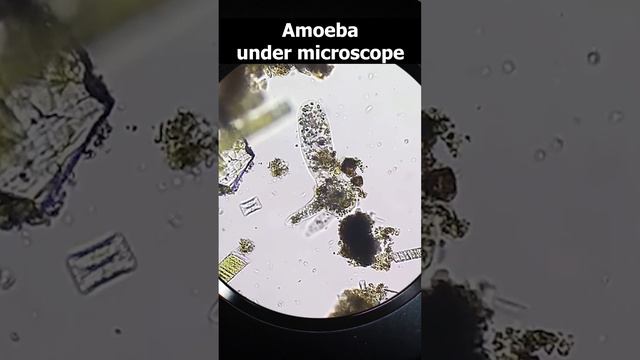 Amoeba under microscope view #shortvideo смотреть онлайн
