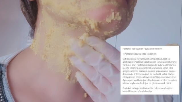 PORTAKAL KABUĞU ile LEKELERİ ÖLÜ DERİYİ KALIP Gibi SOYUP ATTIM?C Vitamini YÜKLEYEN BEYAZLATICI MASK смотреть онлайн