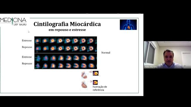 Aula. Medicina Nuclear em Cardiologia. Prof Fabio Martins Silva. LHS 3o Ano. Mod 16. MED USP BAURU смотреть онлайн