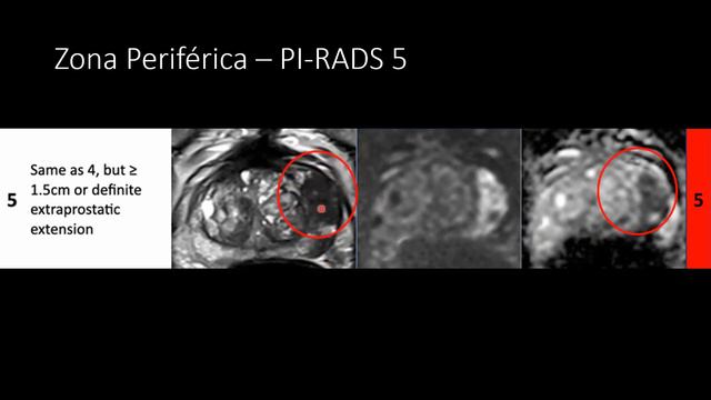 PI-RADS смотреть онлайн