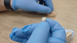 Металлокерамика или диоксид циркония ? В ЧЁМ разница? ?