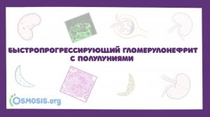 Быстропрогрессирующий гломерулонефрит с полулуниями - причины, симптомы, лечение (лекция)