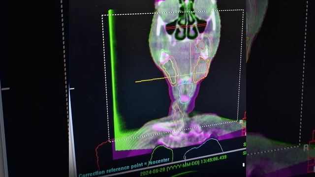 Дмитрий Бенцион, руководитель радиотерапевтической службы ГАУЗ СО 
