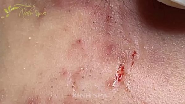 Satifying videos for Relaxation with Xinh Spa channel 5#49