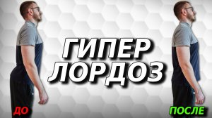 Простой и эффективный комплекс упражнений при поясничном гиперлордозе