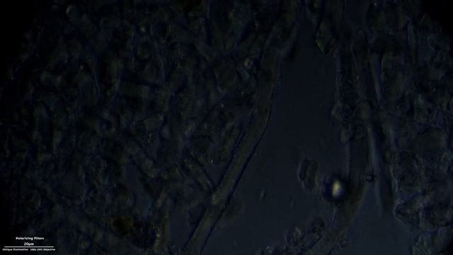 Cladonia arbuscula under the Microscope (Moss-like lichens/Ascomycota) смотреть онлайн