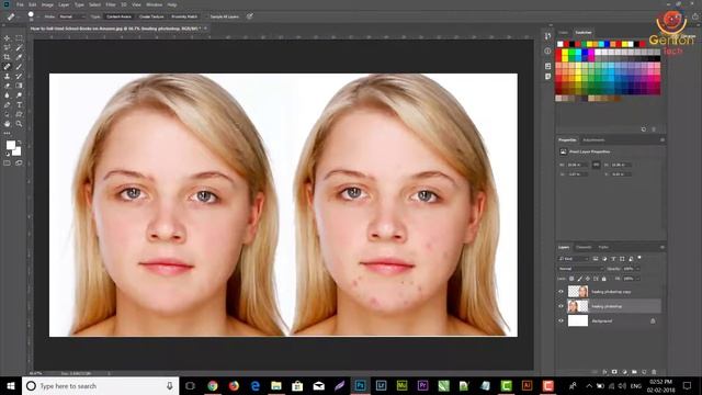 Smoothen Face Skin, Remove Pimples and Blemishes in Photoshop | Healing Brush Tool, Patch Tool смотреть онлайн
