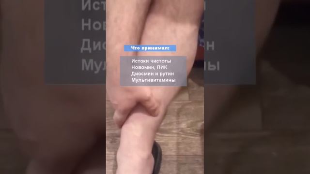 отекают ноги😵 смотреть онлайн