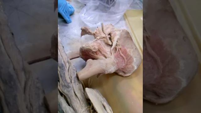 Занятие 14. Короткие ветви крестцового сплетения. смотреть онлайн