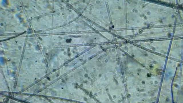 Микробиота смотреть онлайн