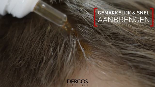 Vichy Aminexil cure смотреть онлайн