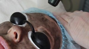 Урок. Лазерный карбоновый пилинг.mp4