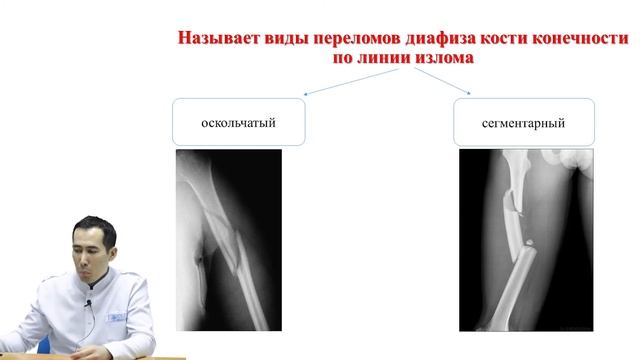Переломы диафиза кости конечностей смотреть онлайн