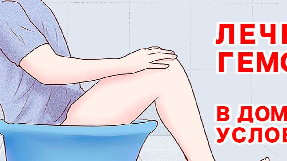 Геморрой - лечение и диагностика, полезные советы от врача. Гемморой - не правильно! Геморрой! смотреть онлайн