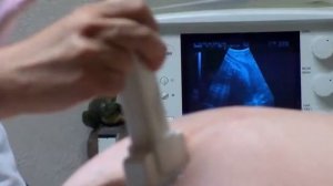 ВАЖНЫЕ ПАРАМЕТРЫ МАЛЫША НА УЗИ | Норма и расшифровка УЗИ во время беременности по неделям