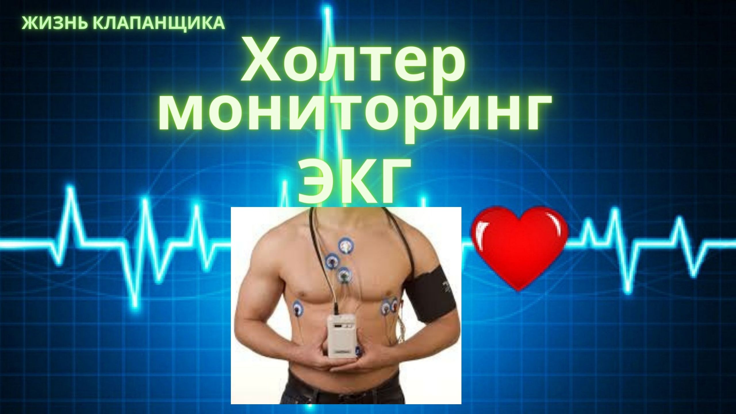Холтер мониторинг суточный. Холтер ЭКГ. Что это и зачем? Жизнь клапанщика. смотреть онлайн