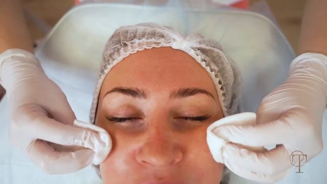 Комбинированная чистка лица смотреть онлайн