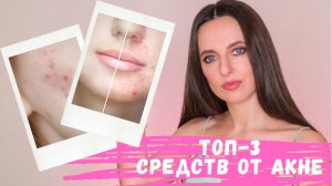 КАК избавиться от ПРЫЩЕЙ | Три СУПЕР средства от АКНЕ