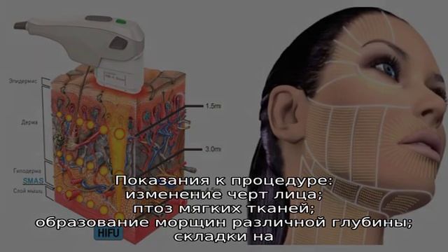 SMAS-лифтинг – все, что нужно знать о глубокой подтяжке