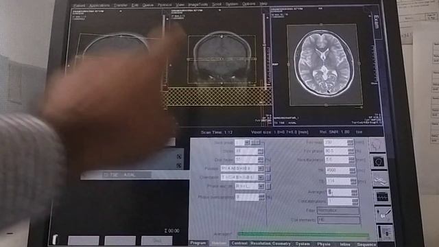 WHAT IS SNR, AVERAGES IN MRI MRI PARAMETERS, WHAT IS MRI смотреть онлайн