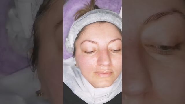 Процедура чистки лица в Алматы смотреть онлайн