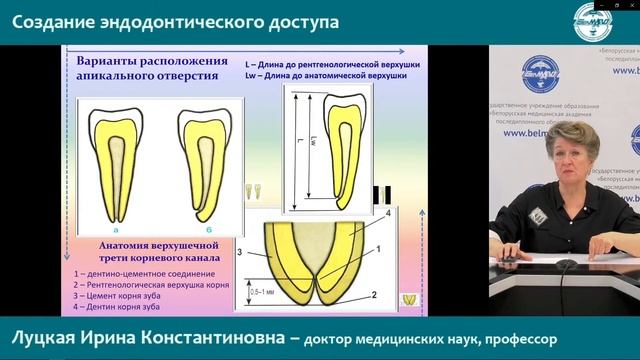 Эндодонтическое лечение постоянных зубов: Создание эндодонтического доступа.
