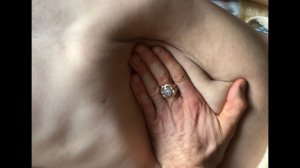 ВАРИКОЦЕЛЕ И ВОДЯНКА ЯИЧЕК. МЕТОДЫ УСТРАНЕНИЯ БЕЗ ПОСЛЕДСТВИЙ И ХИРУРГИИ! Обучение в СтопАптеке - 2