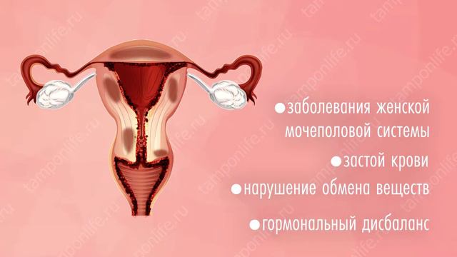 Как действуют китайские тампоны Beautiful Life? смотреть онлайн