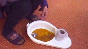 Понос - разглядываем детально. Ищем причины. Инфекционная больница.