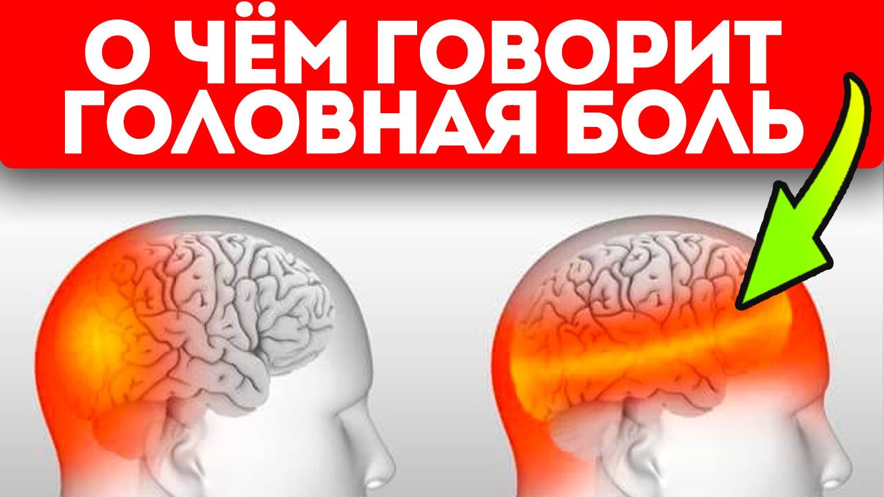 Смотрите, о чём предупреждает тело, когда голова болит так! 6 типов головной боли и что делать смотреть онлайн