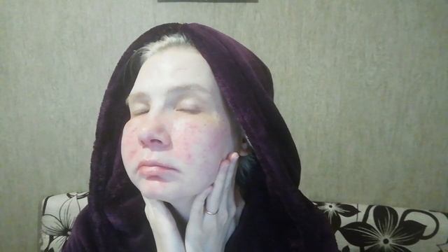 Влог : Второй день, отёк. Фотоомоложение 2 день. Ваш хомяк на связи. Розацеа) смотреть онлайн
