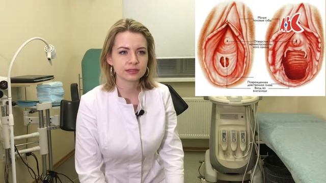 Хирургическая дефлорация. смотреть онлайн