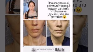 Как восстановить объем щек без набора веса