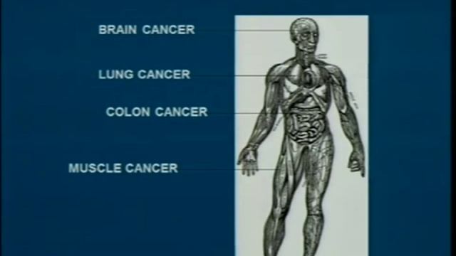 Demystifying Medicine 2015 - New Advances in Cancer Diagnosis and Treatment (Immunotoxins) смотреть онлайн