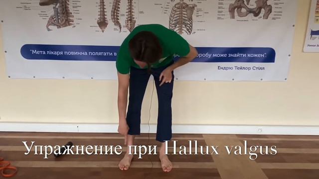 Упражнение при Hallux valgus | ВЕШО смотреть онлайн