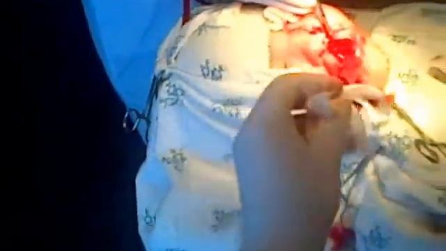 Челюстно лицевая хирургия смотреть онлайн