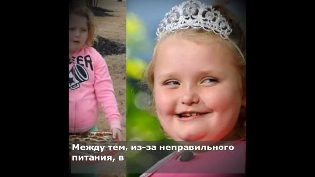 Из милашки в тучного подростка. Как изменилась малышка Хани Бубу спустя 10 лет смотреть онлайн