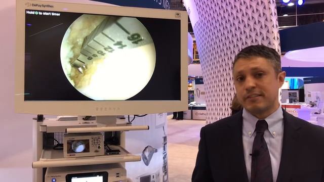 Digital Surgery Solutions: DePuy Synthes PUREVUE Visualization System for Imaging in MIS смотреть онлайн
