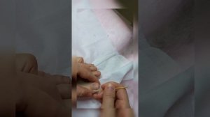 МК: Как поставить тампонаду в домашних условиях, при воспалении или болях в области бокового валика